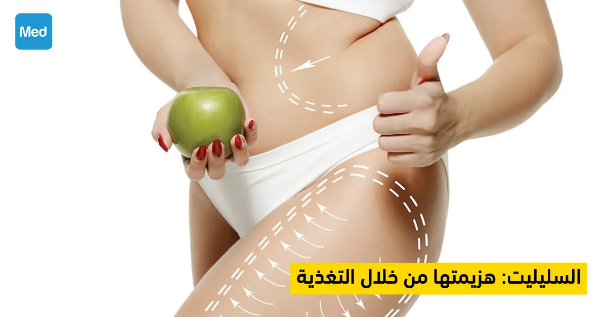 السليليت هزيمتها من خلال التغذية